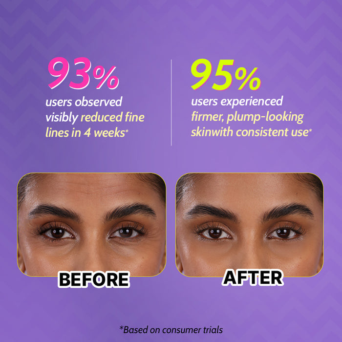0.1% Retinol Night Cream with Aloe Vera For Fine Lines & Wrinkles - 30 gm