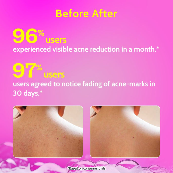 1% Salicylic Acid Body Wash with Lactic Acid | for Acne Control - 236 ml | Pack of 2