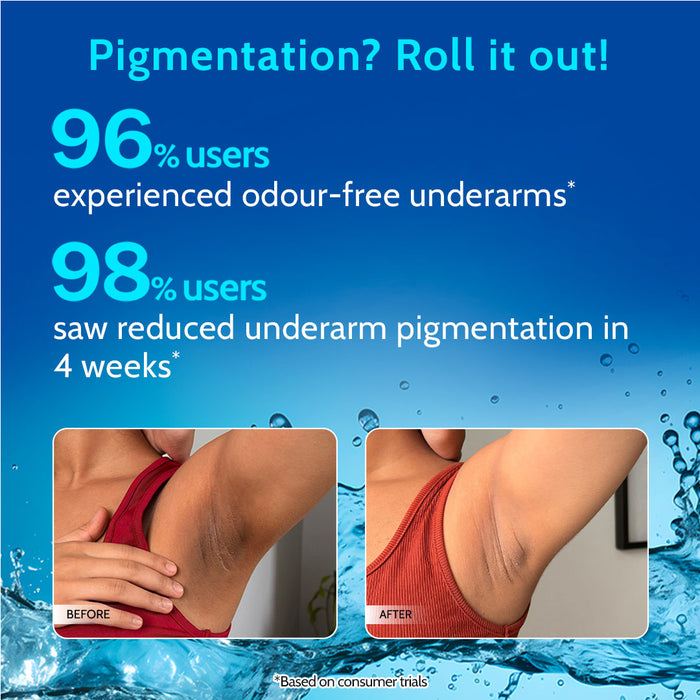 5% AHA Underarm Roll On for Odour Control & Pigmentation (Fragrance Free) - 40 ml | Pack of 2
