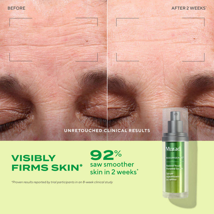 Active Renewal Regimen 90-Day Kit