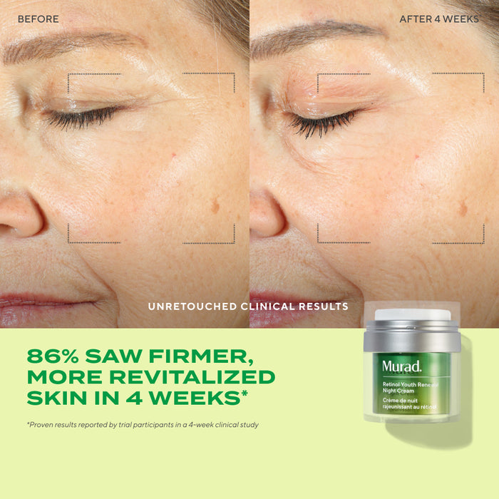 before and after of woman after 4 weeks of using Retinol Youth Renewal Night Cream with text highlighting 86% saw firmer, more revitalized skin in 4 weeks