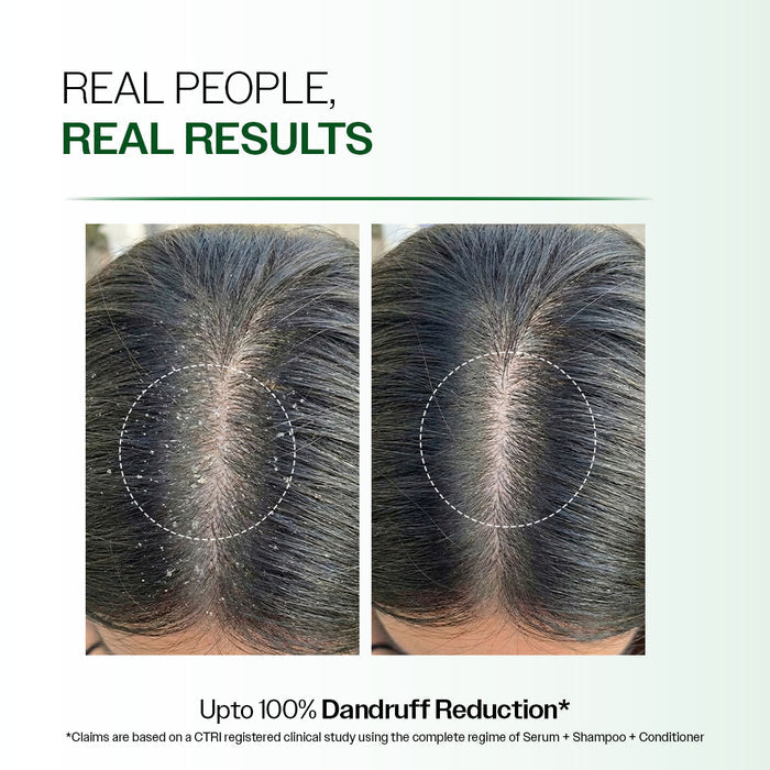 Advanced Anti-Dandruff Serum  With Defenscalp™, Salicylic Acid & Pentavitin - 50 ml | Pack of 2