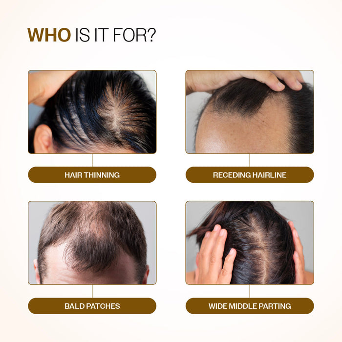 Advanced Hair Growth Serum Roll-On With 5% Rosemary, 4% Anagain, & 3% Redensyl - 25 ml | Pack of 3