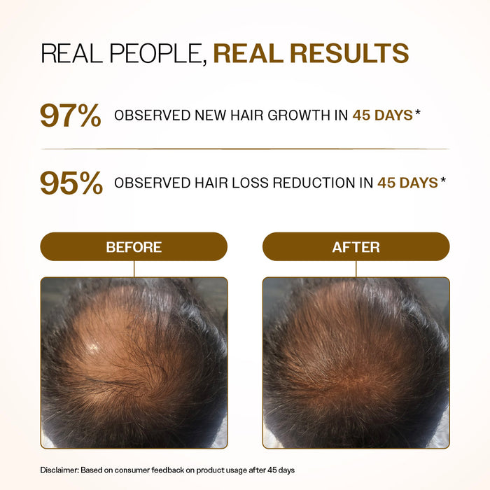 Advanced Hair Growth Serum Roll-On With 5% Rosemary, 4% Anagain, & 3% Redensyl - 25 ml | Pack of 3