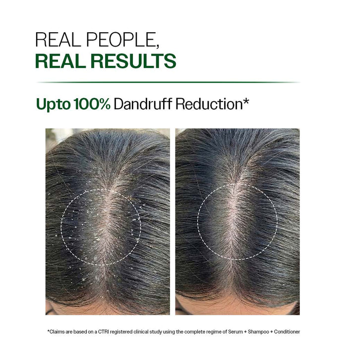 Anti Dandruff Shampoo with Salicylic Acid, Piroctone Olamine & Biotin - 100 ml | Pack of 2