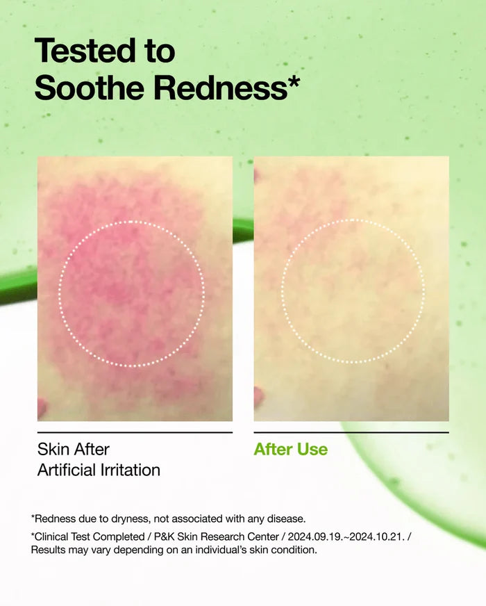 ANUA 10 ANUA AZELAIC ACID 10 HYALURON REDNESS SOOTHING SERUM سيروم التهدئة بالازليك اسد من انوا