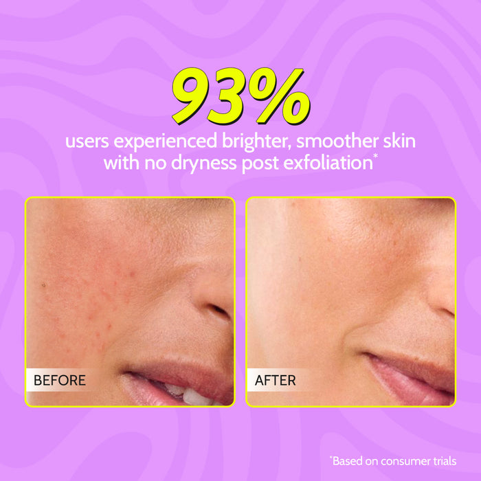 Complete Exfoliation Duo | Gentle Exfoliating Face Scrub - 100 ml & Exfoliating Body Scrub - 75 gm
