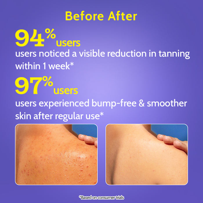 Exfoliating Body Wash with 1% Lactic Acid & 2% Salicylic Acid - 236 ml | Pack of 2