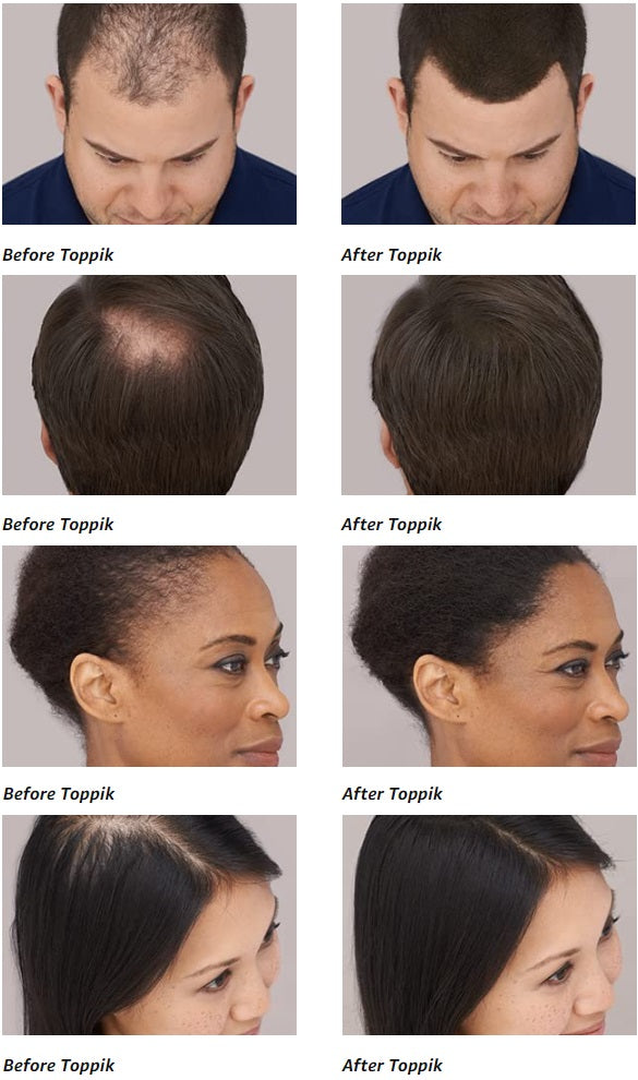 Hair Building Natural Keratin Fibers [Flash Sale!] Blossom Online UG