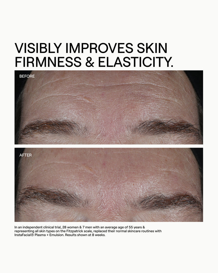 INSTAFACIAL® COLLECTION DUO