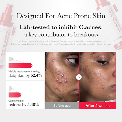 MEDICUBE Hypochl Orous Acid Daily Facial Spray سبراي البشرة من ميديكيوب