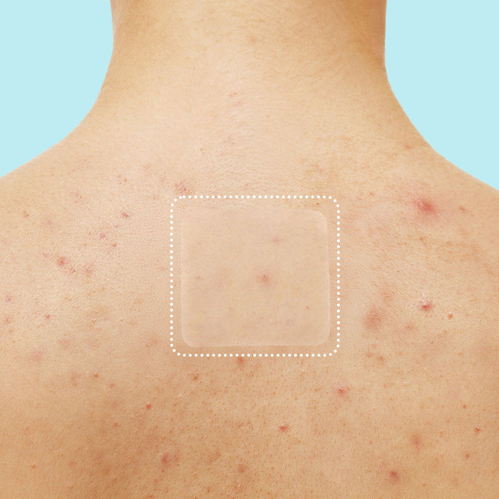Miracle Patch XL Spot Control Cover