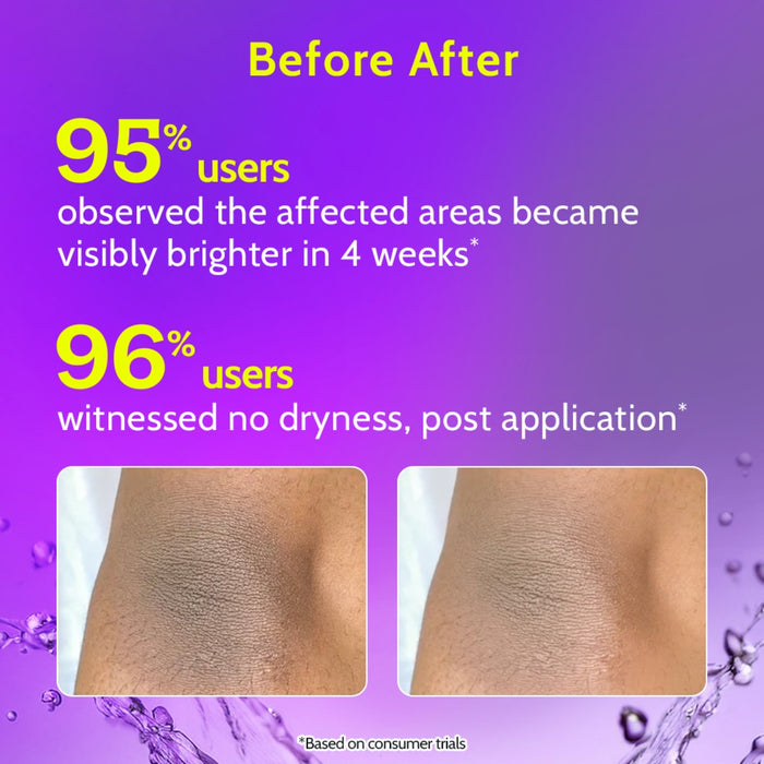 Neck, Knee & Elbow Roll On & Underarm Roll On (Fragrance Free) - 40 ml Each