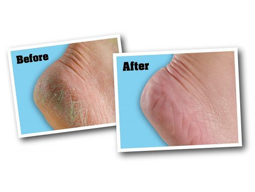 O'Keeffe's Healthy Feet Foot Cream كريم العناية بالقدمين من اوكيفز