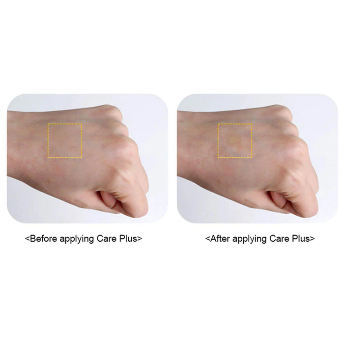 Olive Young Care Plus Scars Cover Spot Patch 102 pcs