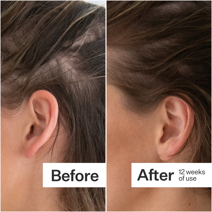 Plant Based Hair Capsules
