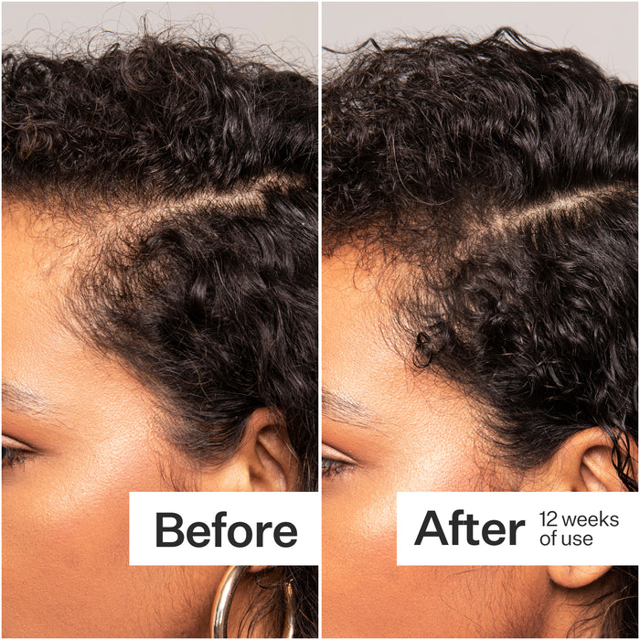 Plant Based Hair Capsules