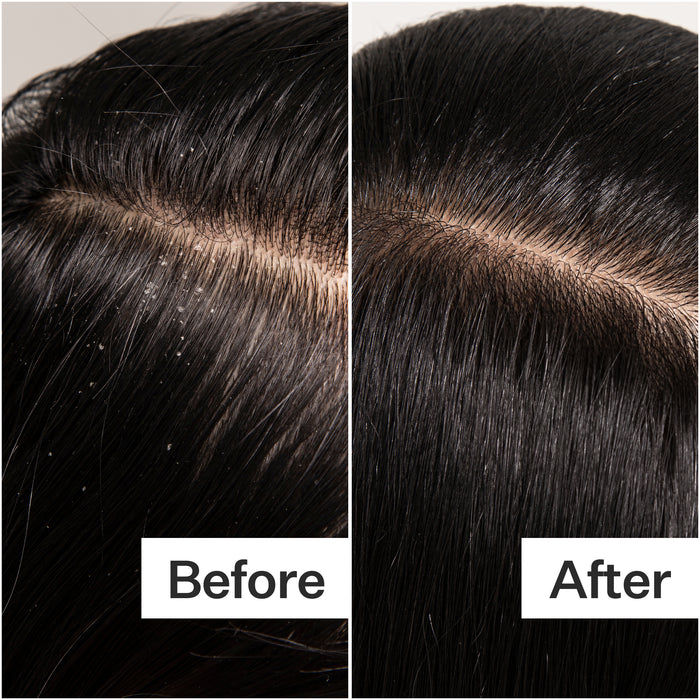 Scalp Detox