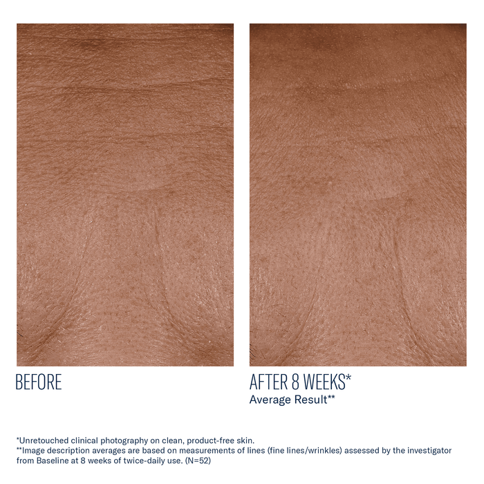 Before and after 8 weeks clinical skin comparison showing fewer fine lines and wrinkles on neck