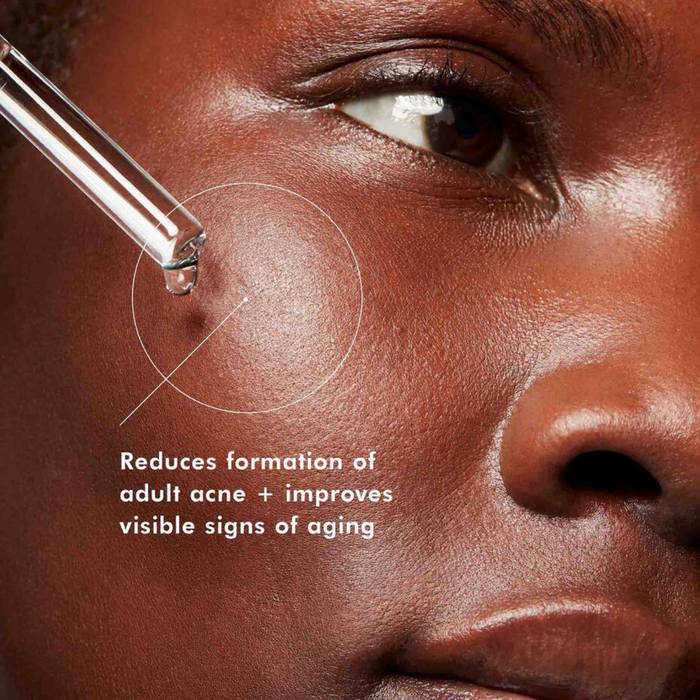 anti-acne-serum