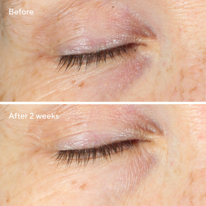 Vita-C Eyes Dark Circle Corrector