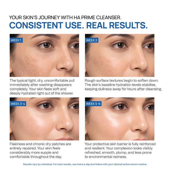 Yuderma HA Prime Hydro Infusion Moisturiser Foaming Cleanser